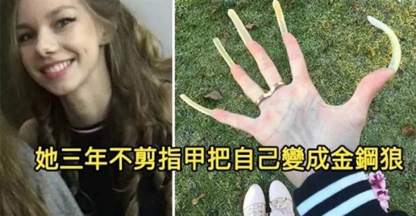 德國女孩「三年不剪指甲把自己變成金鋼狼」滿手魔爪！因為指甲太長連「體育課都不能參加」還沾沾自喜